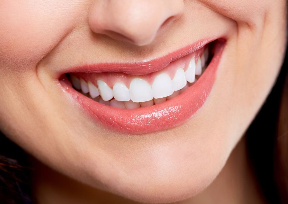 Smile Makeovers: Transform Your Smile with Cosmetic Dentistry 